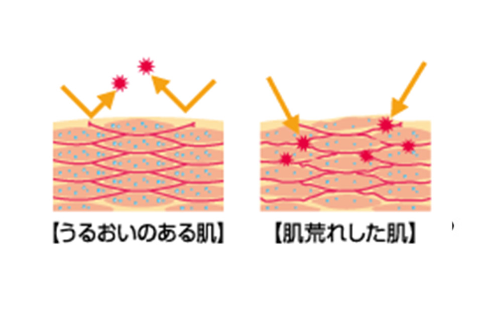 乾燥肌 カサつく つっぱる 乾燥肌から抜け出そう スキンケア ヘアケア 基礎化粧品のウテナ