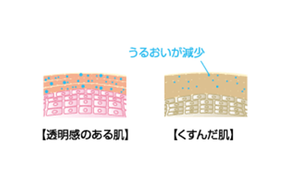 くすみ 角質 くすみ 角質ケアで透明美肌を取り戻す スキンケア ヘアケア 基礎化粧品のウテナ